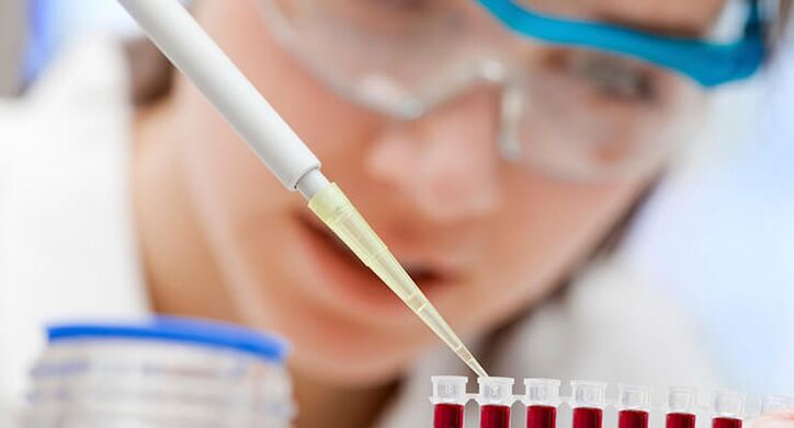 Diagnoza artrozy stawu biodrowego